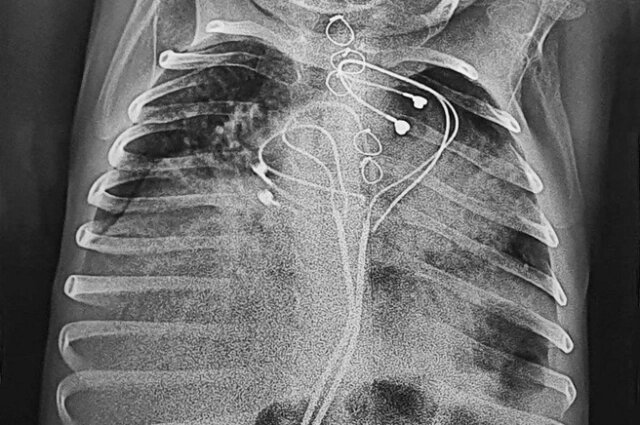    Фото: НМИЦ им. академика Е. Н. Мешалкина/ Пресс-служба