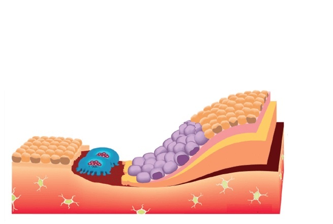 Схемматичное изображение клеток выстилки костной ткани