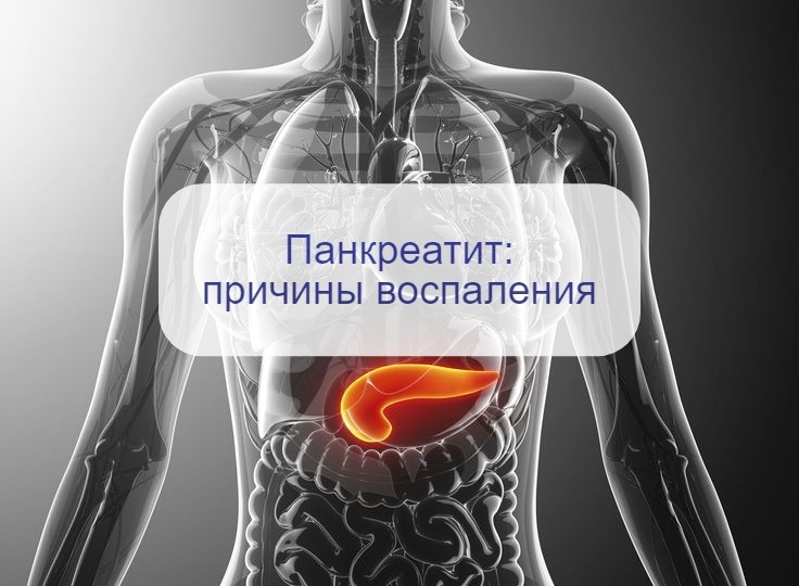 Почему возникает панкреатит – ведь ничего раньше не болело и не беспокоило? Всегда ли виновен алкоголь