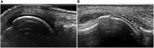 Двойной контур - изображение В.