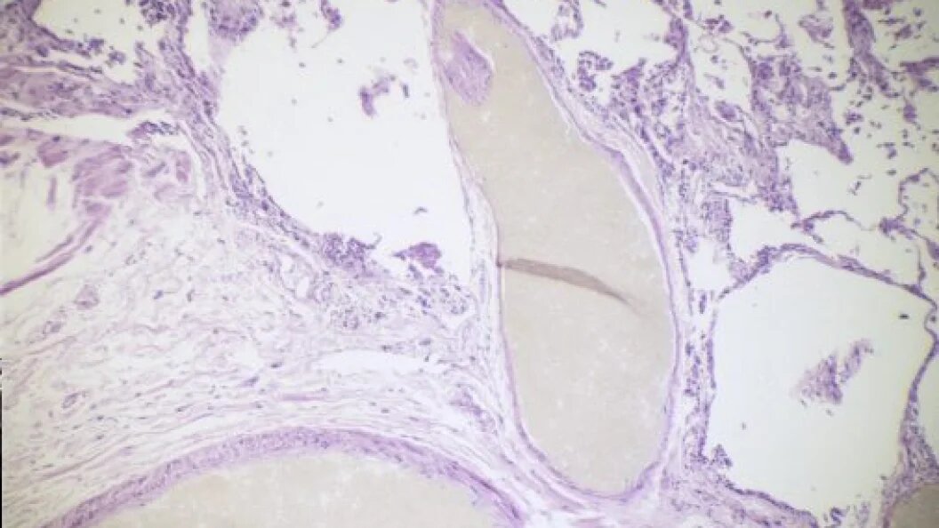    © Custom Medical Stock Photo/Globallookpress