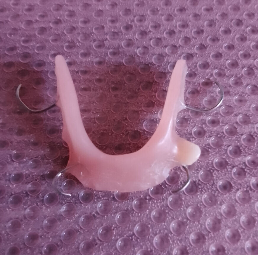 Коронка для верхней челюсти