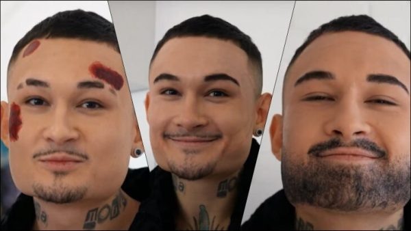    Недавно Моргенштерн* свел тату с лица, фото: соцсети