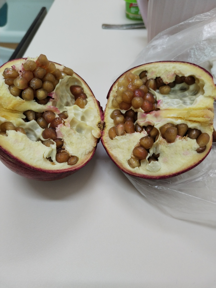 Гранат привезла в больницу и выкинула в мусорку.