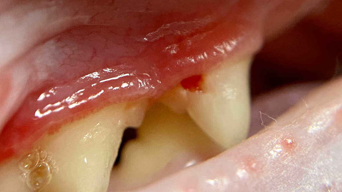 Отверстие в зубе - характерный признак резорбции