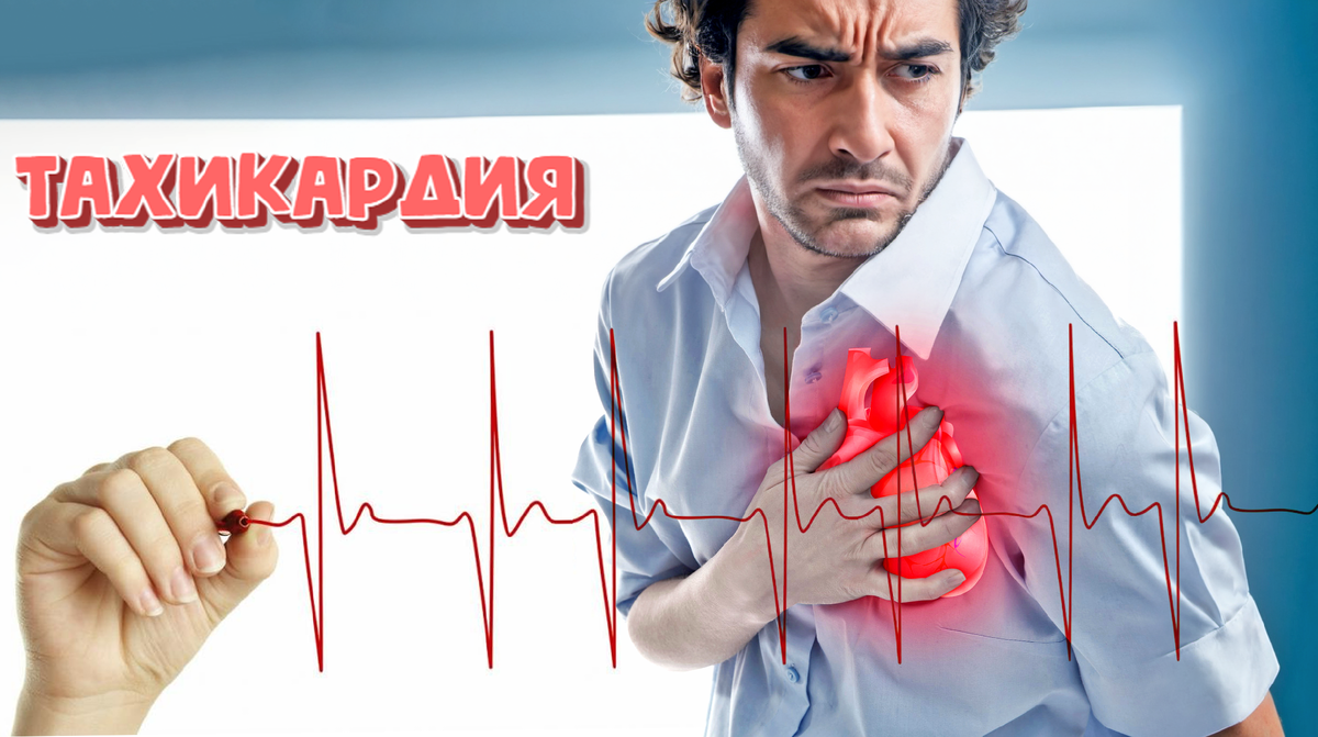 💓 Тахикардия: когда сердце "выходит из-под контроля". Причины, симптомы и что делать, если сердце "сорвалось с цепи" 
