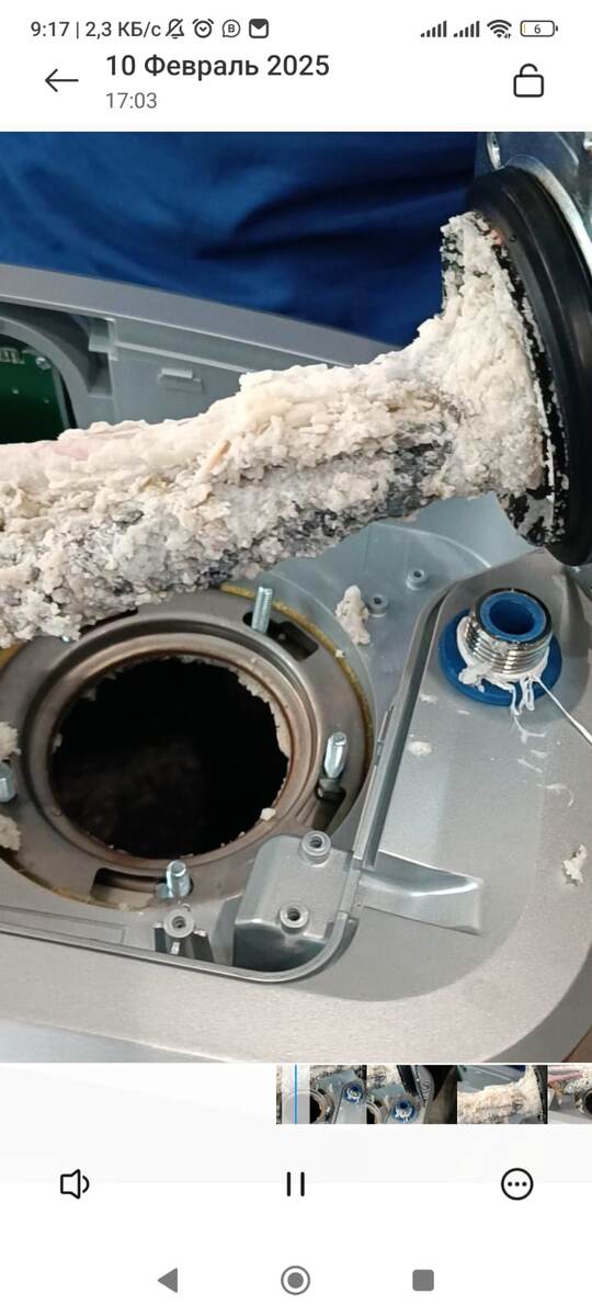 Поражение накипью и остатками анода.