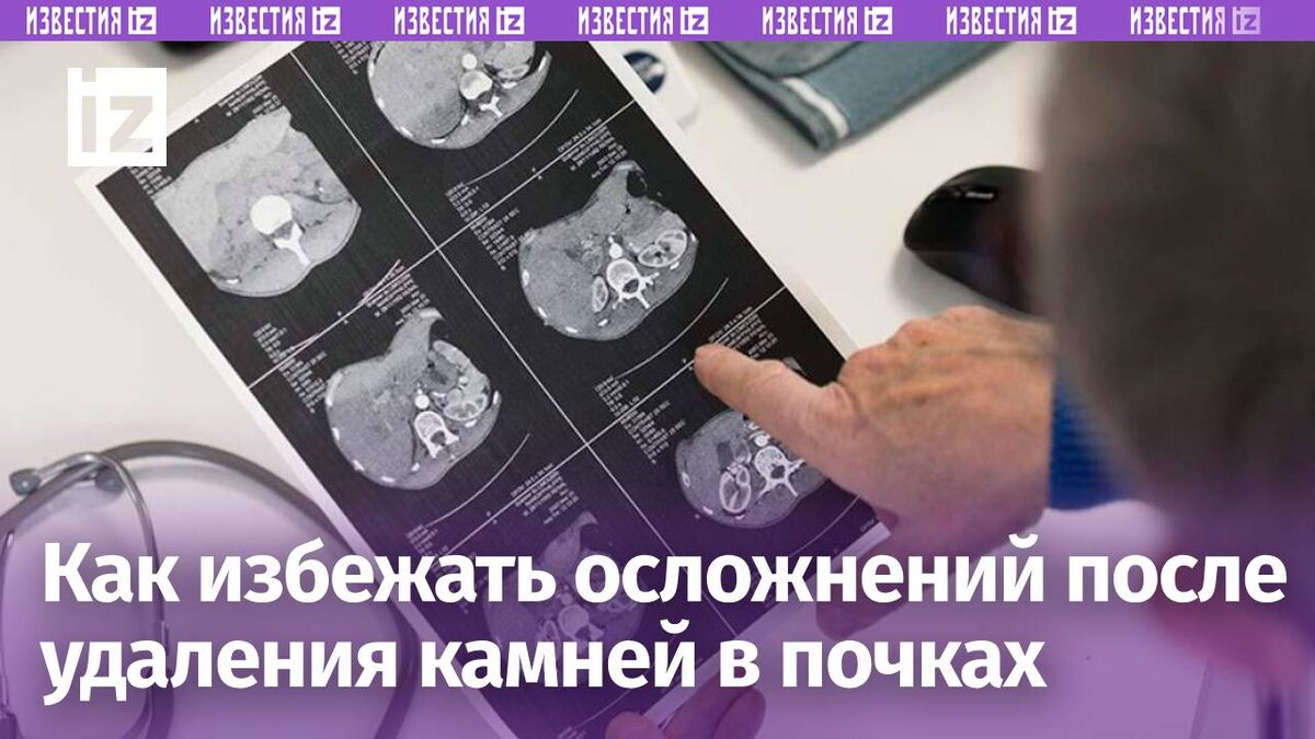 Фото: Getty Images/BSIP