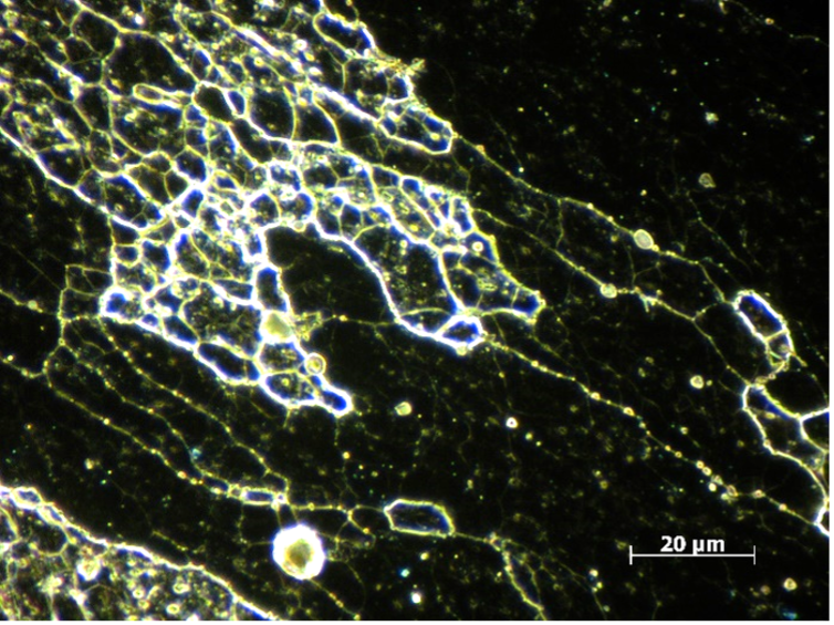 Вид структуры Al-сплава