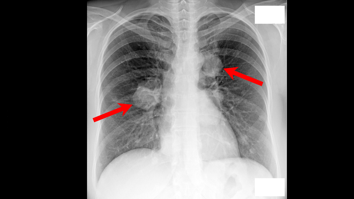 Флюорография. Осень 2024 года.