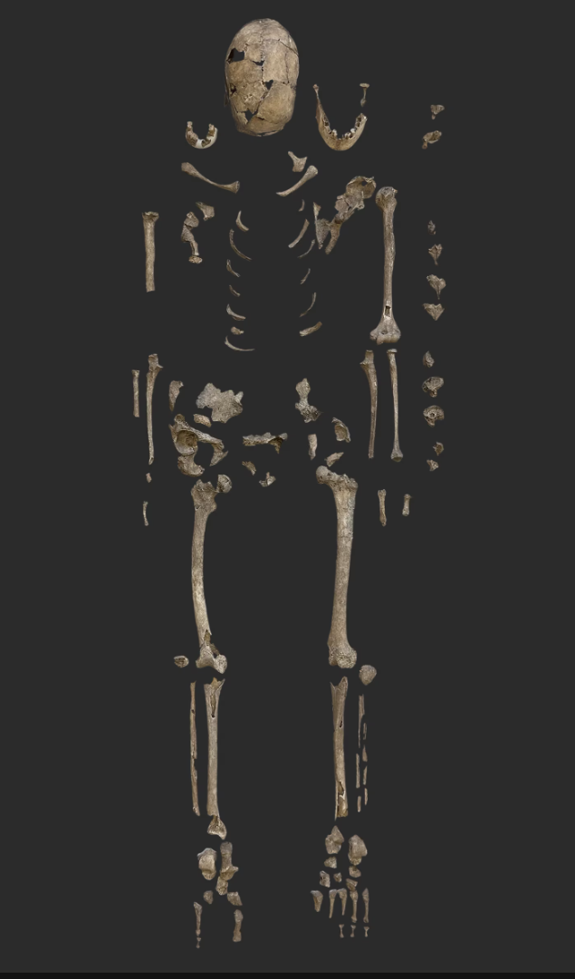 Скелет из погребения 63 был раскопан в 1980-х годах и оказался в коллекциях Венгерского университета Сегеда.