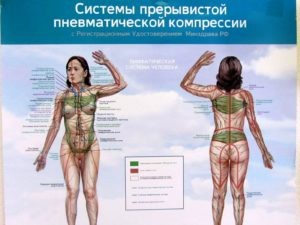 Лечение спины. Компрессионная стимуляция