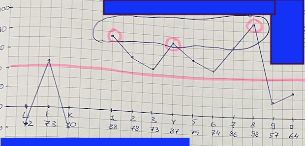 В СМИЛе очень важны не только абсолютные значения отдельных параметров, но и их взаимосвязь. Для профессионалов и студентов выкладываю его профиль