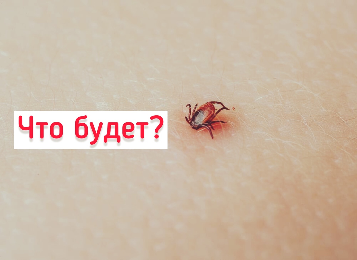 Что будет после укуса клеща?