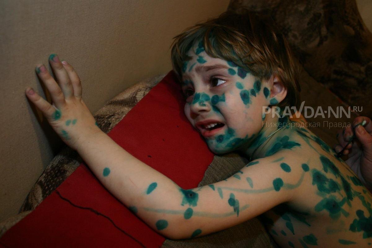    Невозможно предсказать, как именно организм ребенка отреагирует на вирус