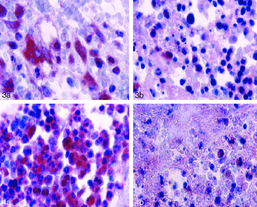 стоматология, обработка пульпы лазером