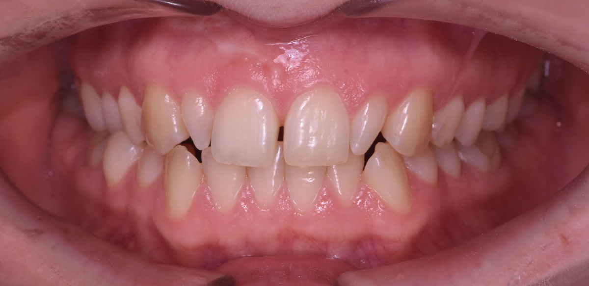 Кейс пациентки: до начала лечения.