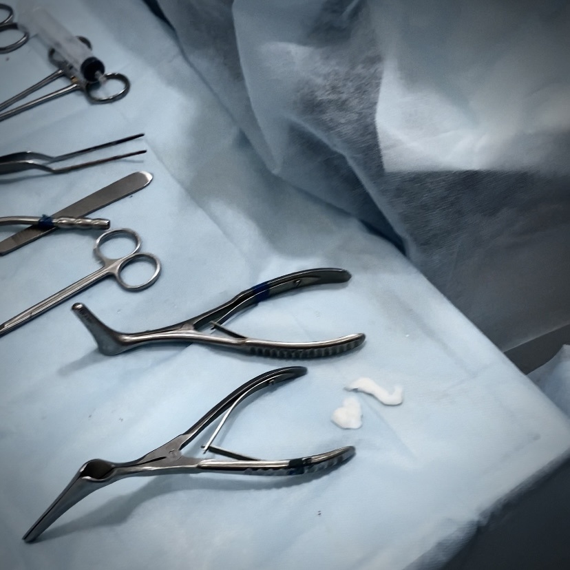 На фото интрументы для септопластики (операция по искривлению носовой перегородки). 