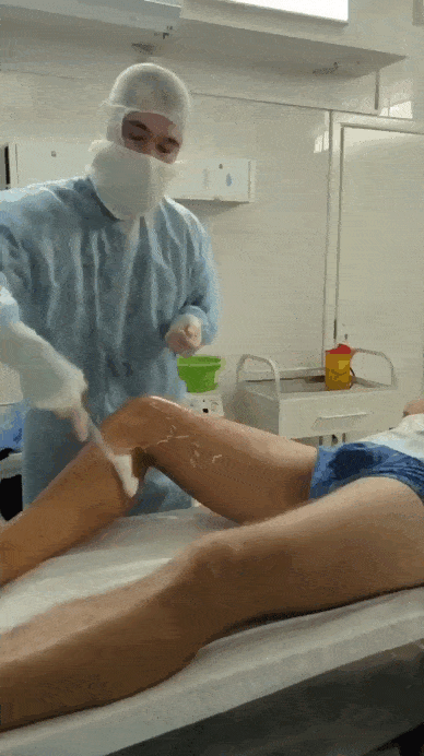 Ускоренная демонстрация современного лазерного лечения - сразу после операции Пациент встает и через 10 минут покидает клинику