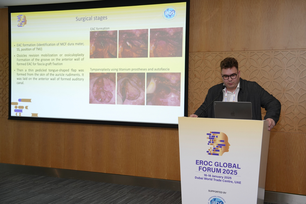 Собственно моё выступление. 