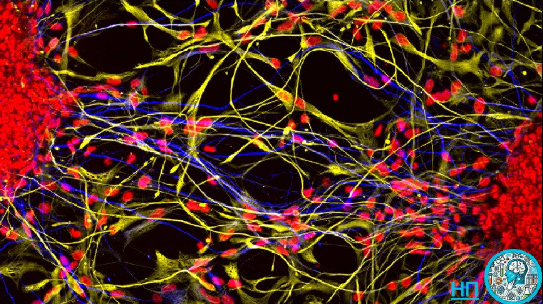 Нейроны (показаны желтым цветом) в мозговых органоидах, вдохновленных неандертальцами, или трехмерной, самоподдерживающейся мозговой ткани в чашке, активизируются более хаотично и развивают меньше взаимосвязей, чем современные человеческие «мини-мозги». Это могло сделать неандертальцев менее проворными мыслителями. Это, в свою очередь, могло означать, что они были менее искусными охотниками и собирателями, чем современные люди.