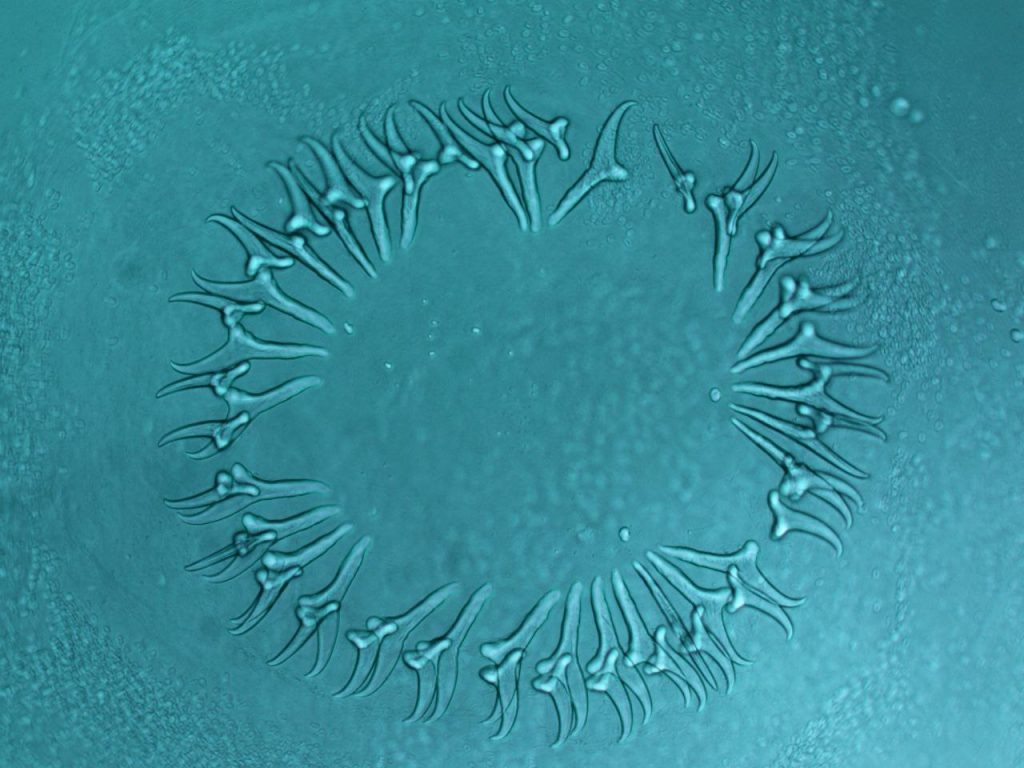 Паразит Kontrimavichusia testiculata sp. nov. Фото: пресс-служба Южного научного центра РАН