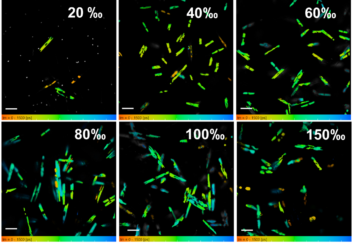 Изображения диатомовых водорослей при разной солености, полученные с помощью флуоресцентной время-разрешенной микроскопии. Источник: Дмитрий Горин