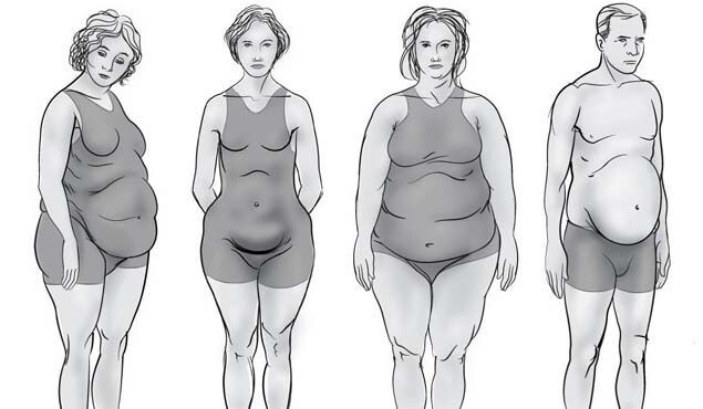 Абдоминальный Тип Ожирения 