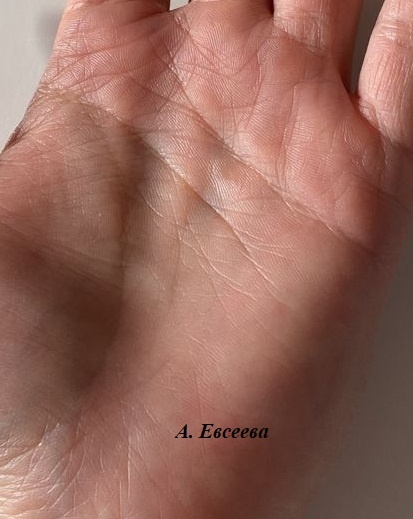 Рука с множеством линий.