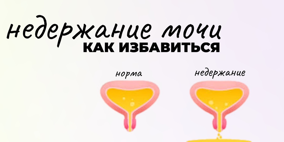 "Недержание мочи – это не приговор! Почему одни упражнения не помогают?"