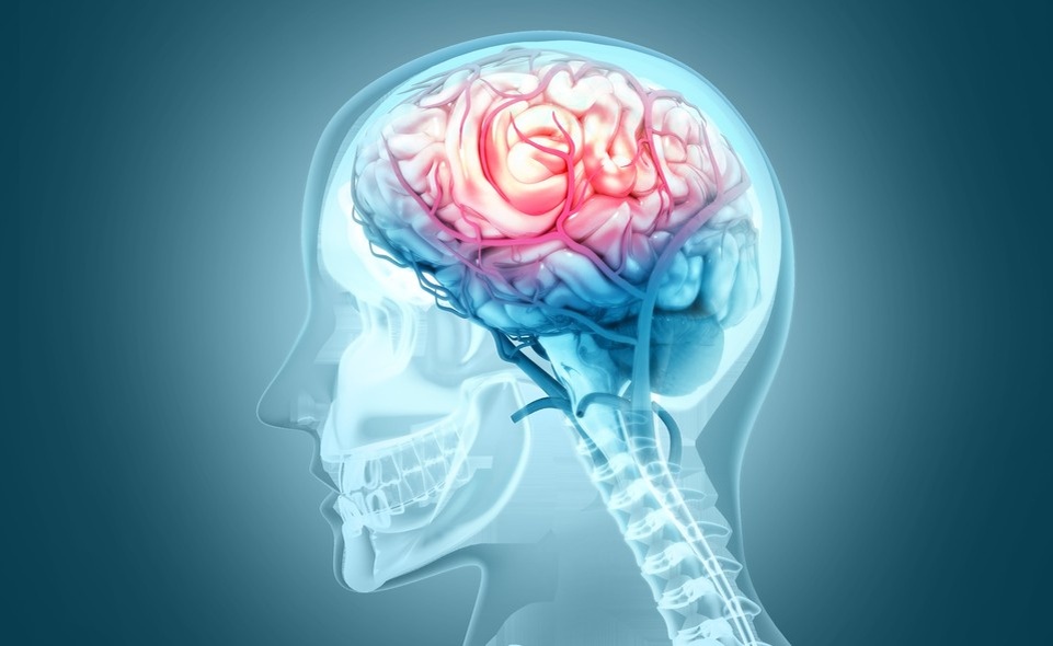       ,             Shutterstock