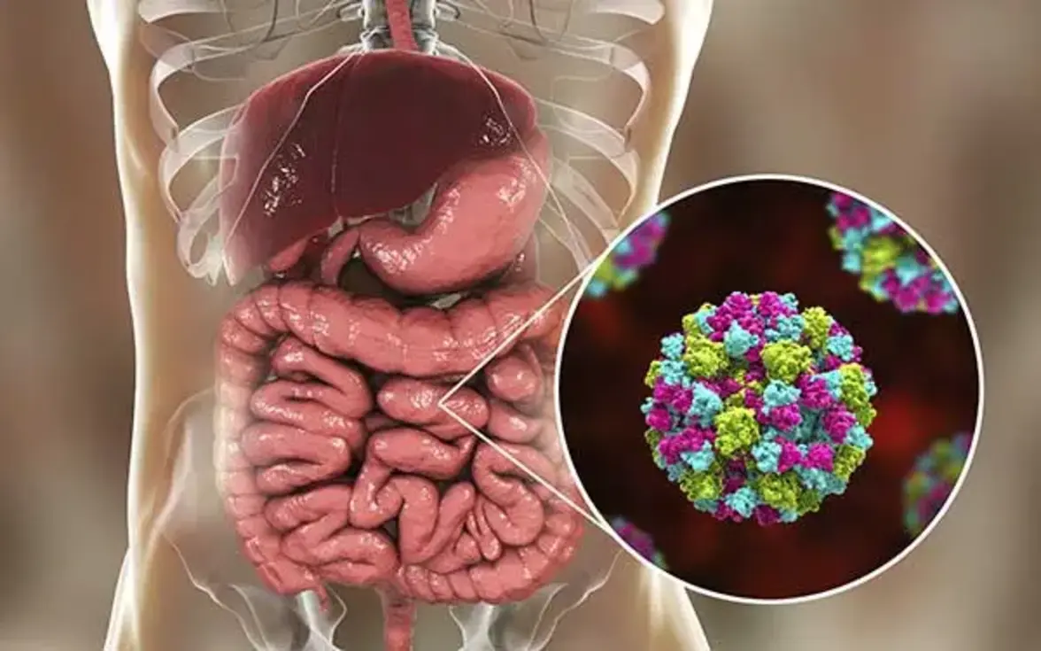 Иллюстрация: ercare24.com