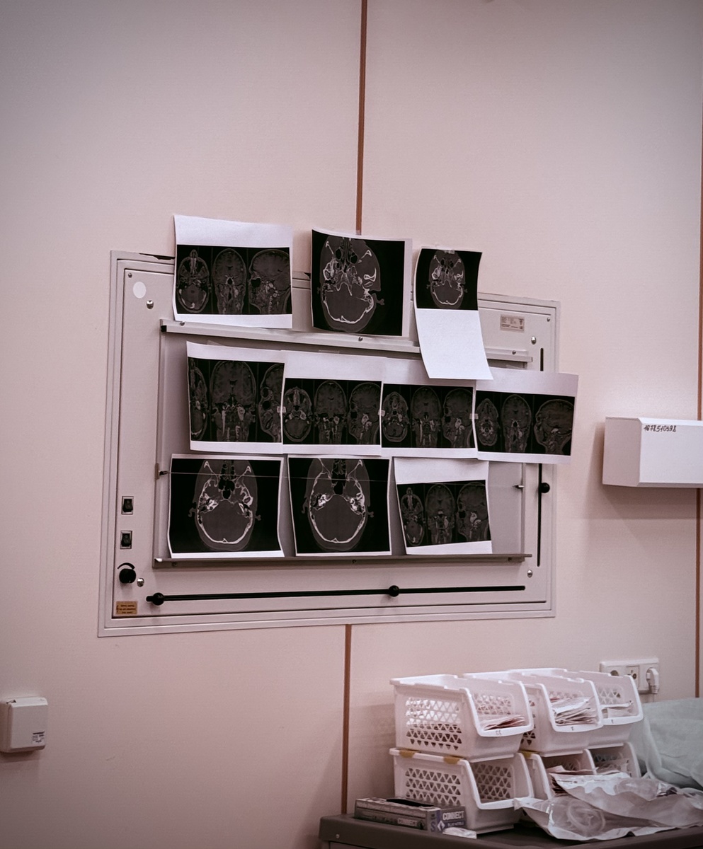 Фото из операционной. На стене вывешены снимки компьютерной томографии. 