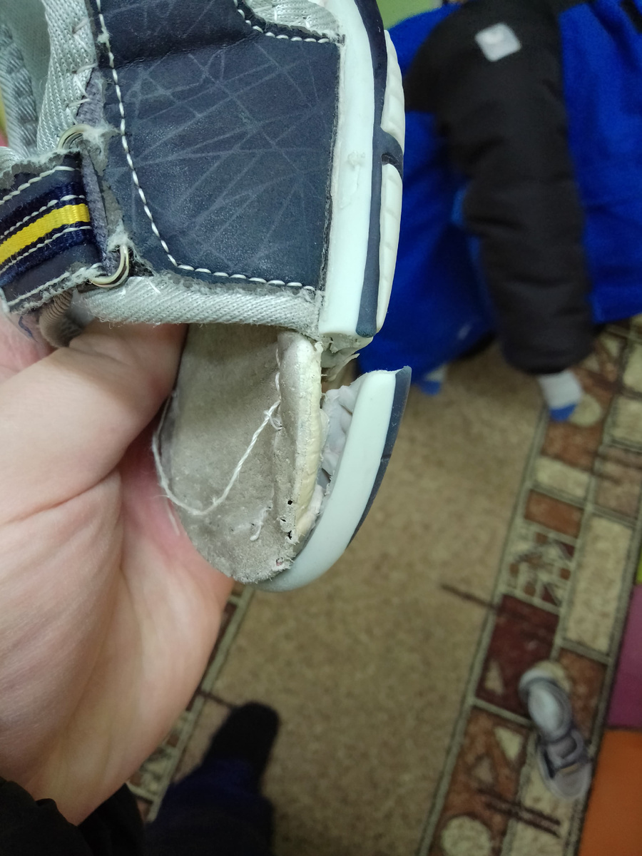 Здесь не видно, но кроме этого ещё и ремешок на пятке с корнем выдран