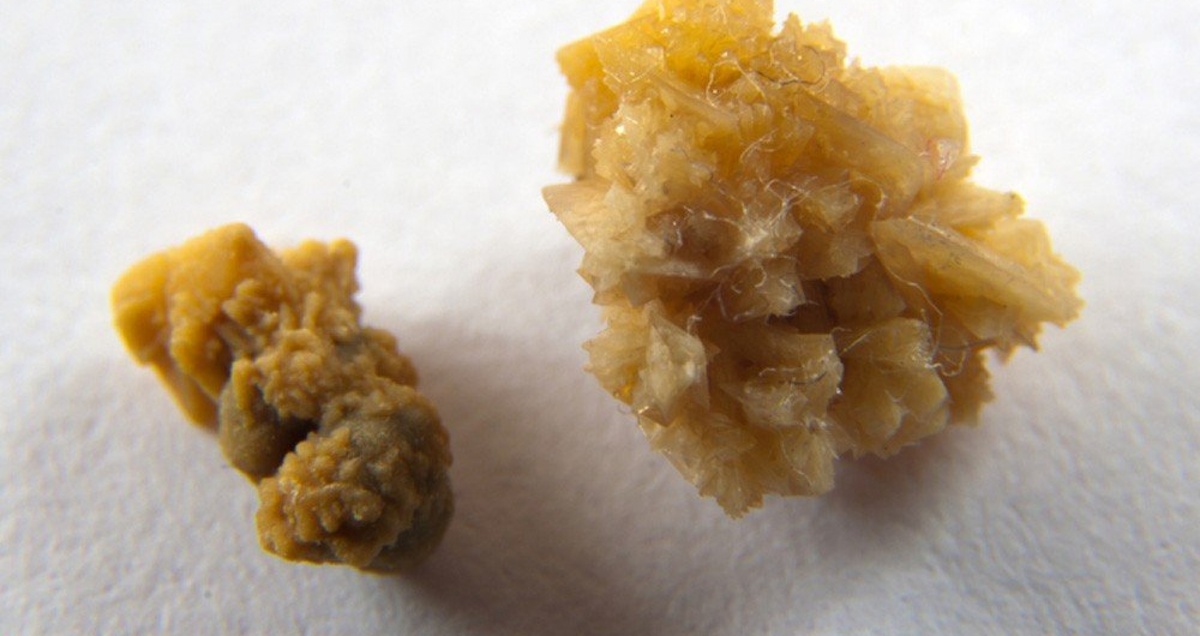 Подобные камни доктор Менгели предпочитал всем прочим