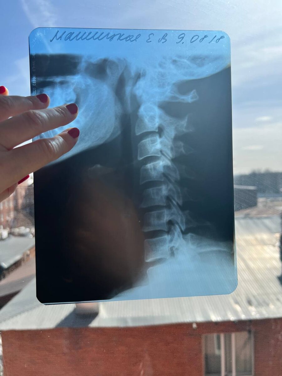 мой рентген шеи от 9.08.18 