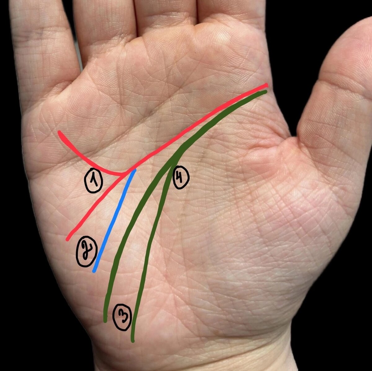 Разветвления на линии головы. Рисунок автора. 