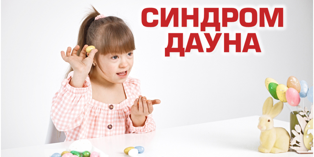 СИНДРОМ ДАУНА