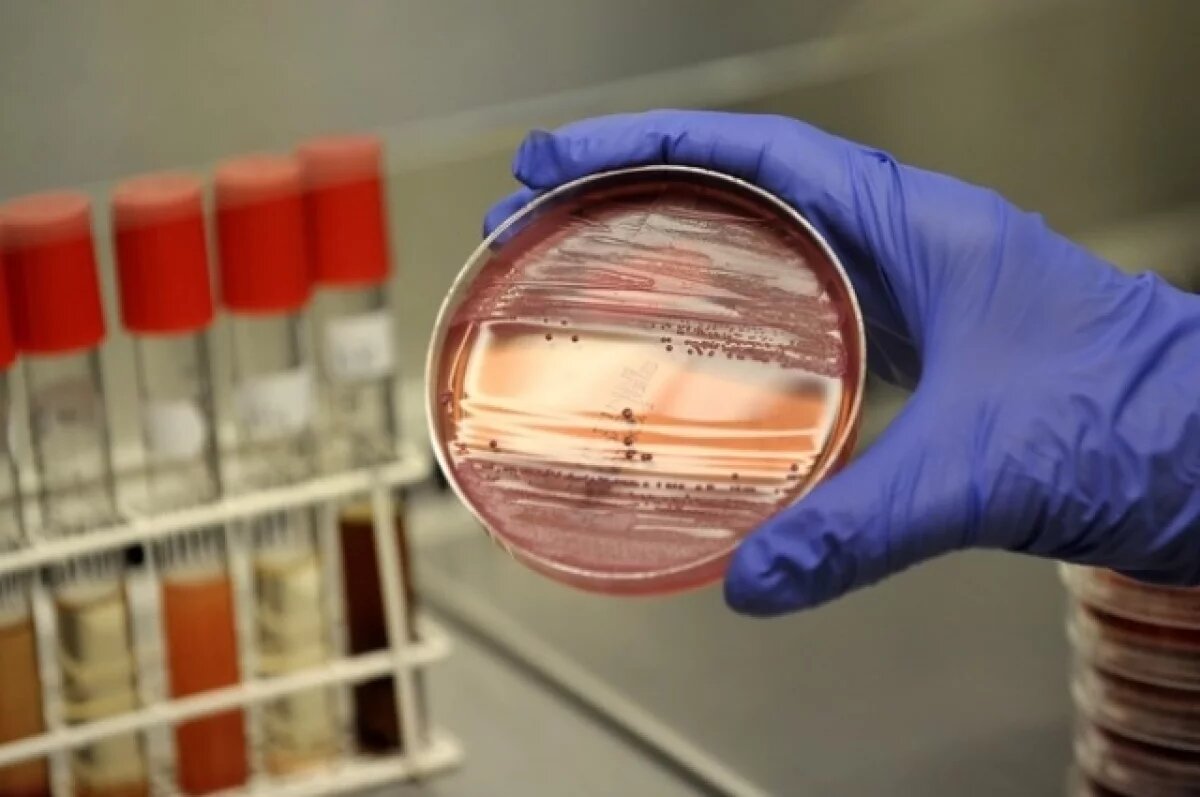    Новосибирцам рассказали об осложнениях при заражении кишечной палочкой