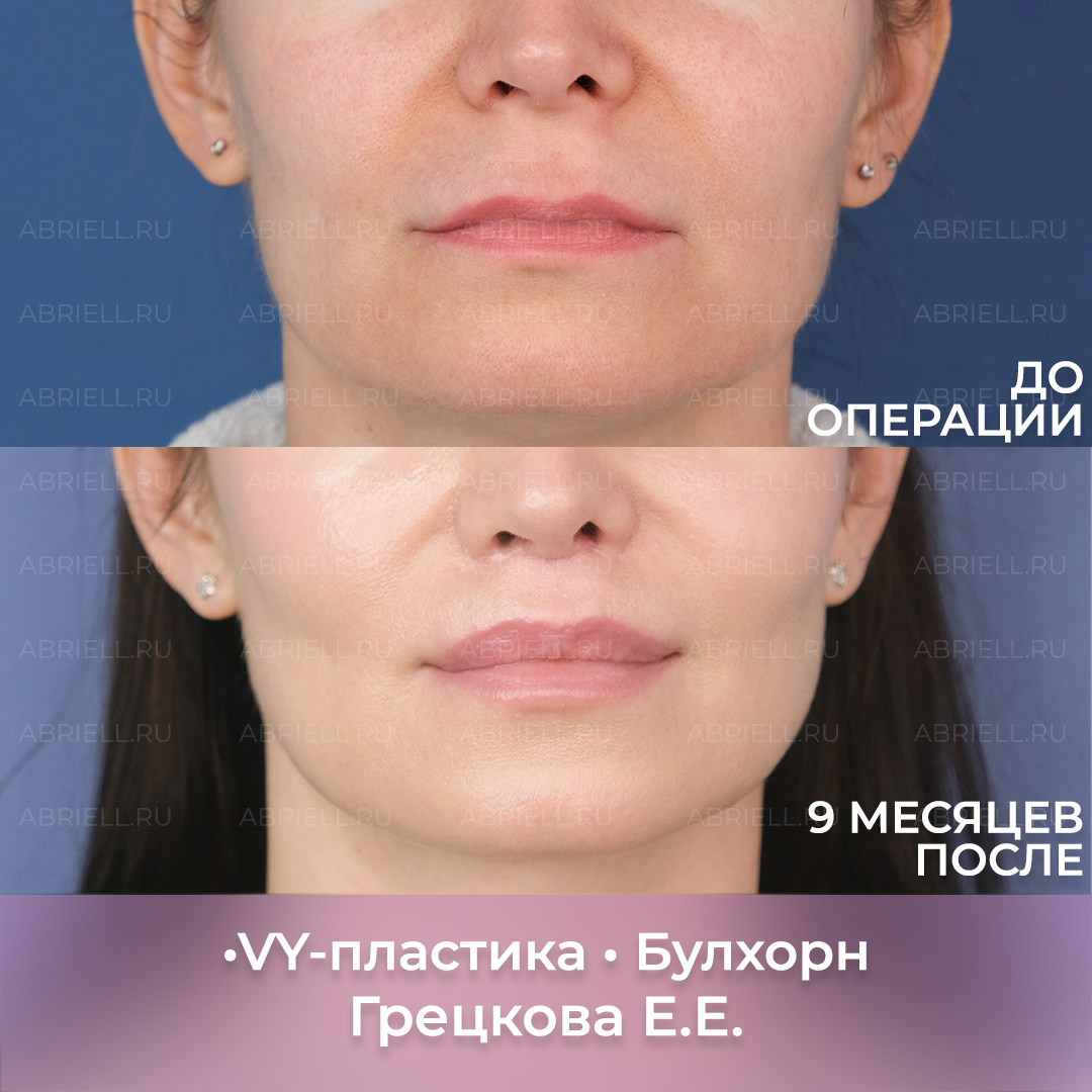 Хирург: Грецкова Е.Е. 