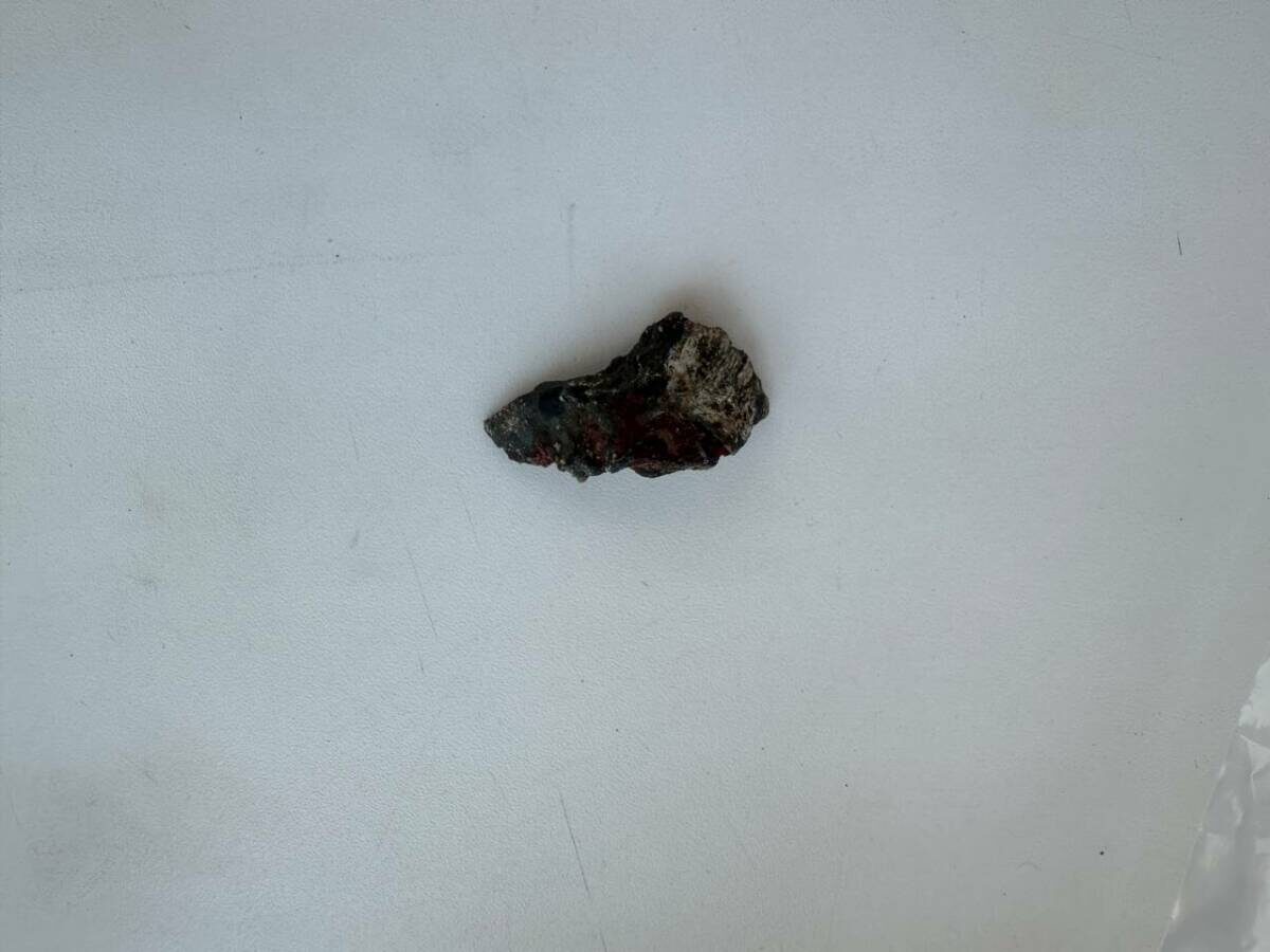 Фото: Пресс-служба РКБ Татарстана