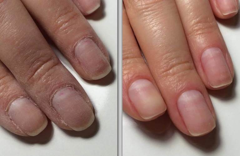 После сухого аппаратного аникюра руки выглядят намного лучше, чем после мокрого. Но я все равно обычно не хожу на ногти / uslugi.yandex.ru