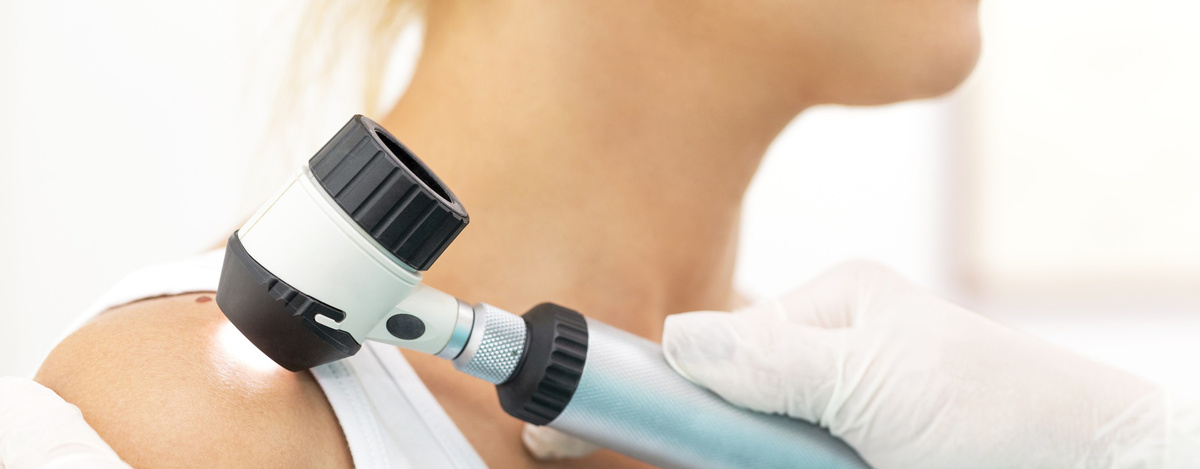 Дерматоскопия - диагностика новообразований кожи