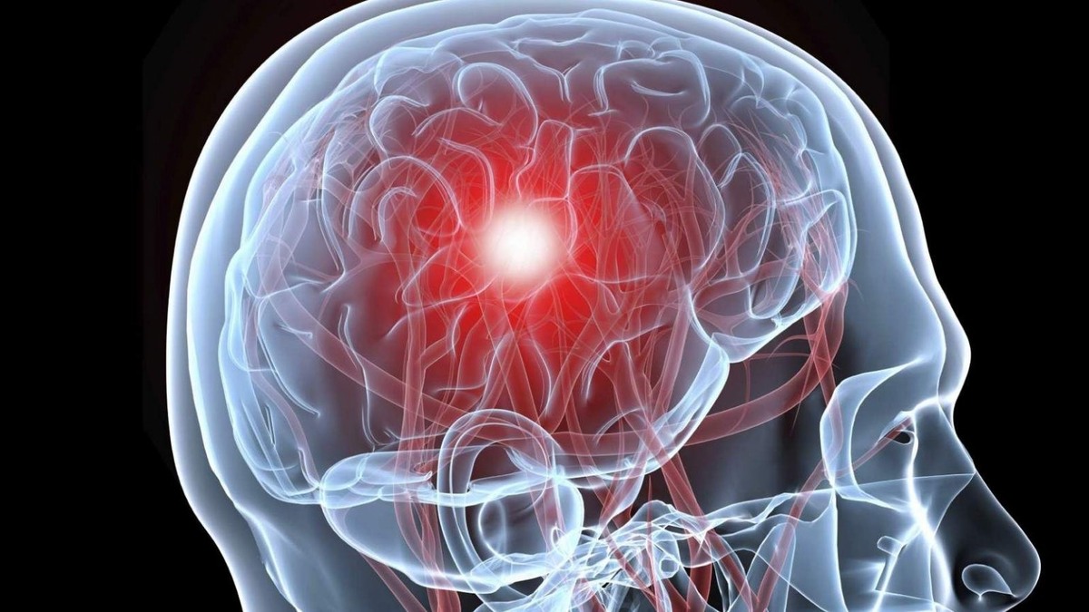 Картинка взята из открытого доступа на Яндексе https://ya.ru/images/