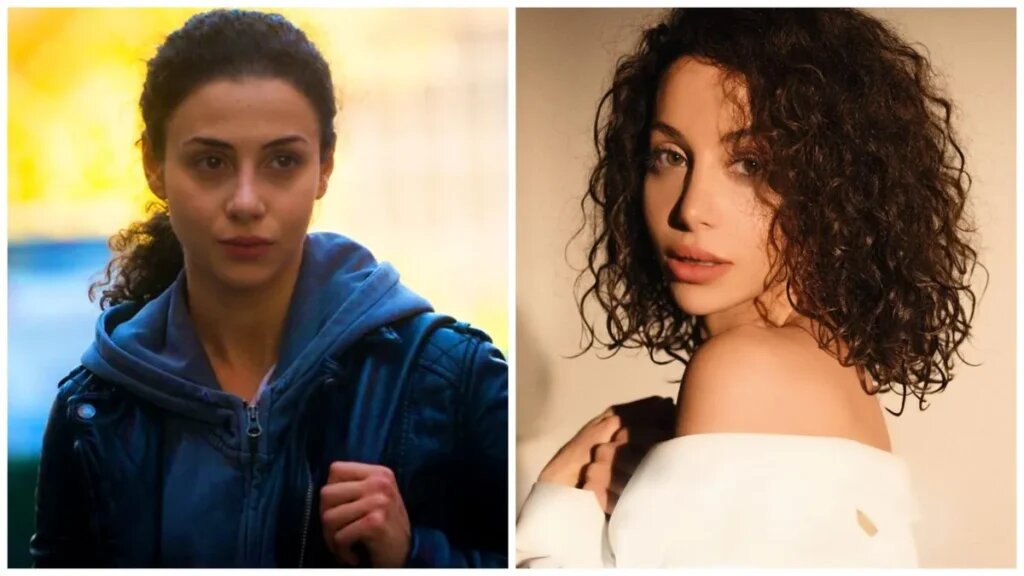    Зепюр Брутян до пластики и после