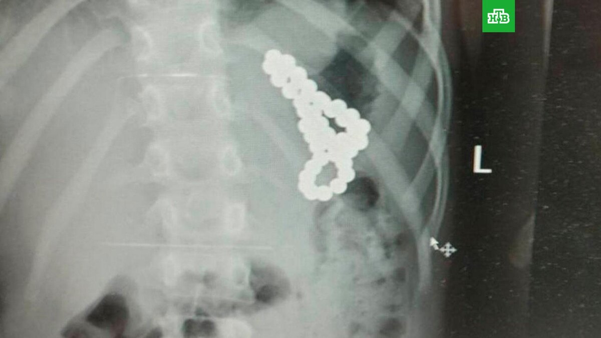    Фото: dzdmos / t.me