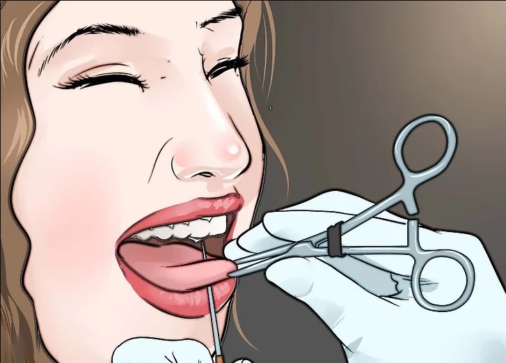 Демонтрация процедуры прокола языка