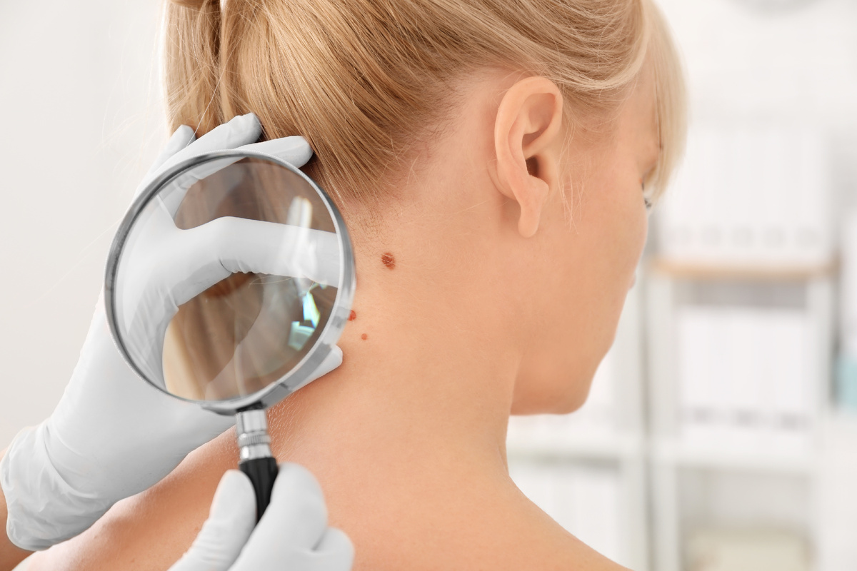 Процедура особенно рекомендуется пациентам, которым необходимо удалить образование быстро и безболезненно, с минимальным риском рубцевания и осложнений.