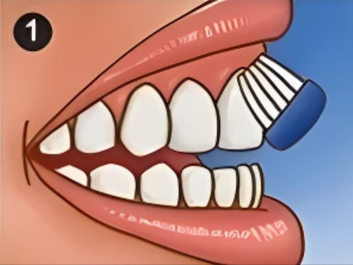 Ставим щётку под углом 45 градусов. Щетинки должны соприкасаться с зубами и линией дёсен. Делаем выметающие движения сверху вниз.