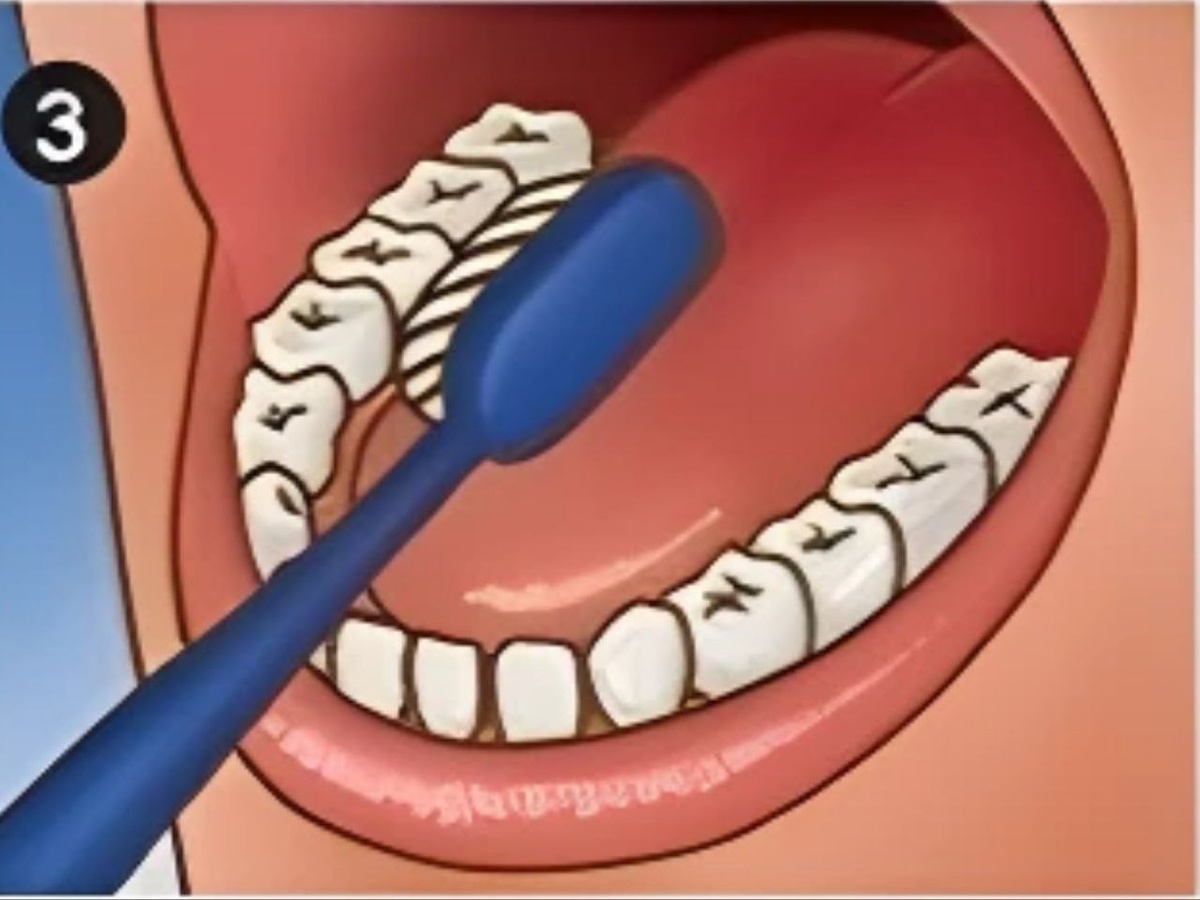 На нижней челюсти выметаем снизу вверх